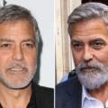 George Clooney’s Hair Transplant Journey: A Lesson in Confidence and Restoration