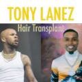 Tory Lanez Hair Transplant: A Glimpse into His Hair Evolution 