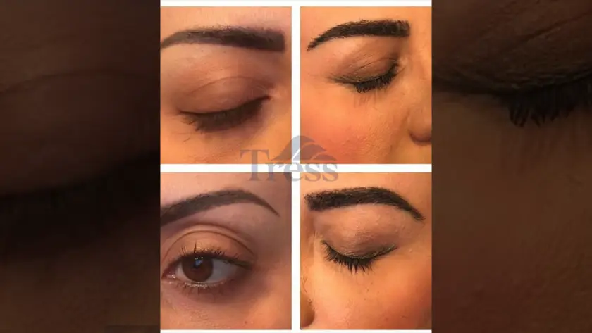 Eyebrow Transplant Clinic