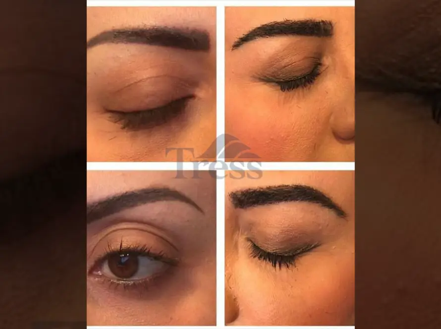 Eyebrow Transplant Clinic