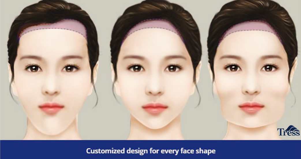 Forehead Reduction