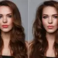 Forehead Reduction Surgery Before and After