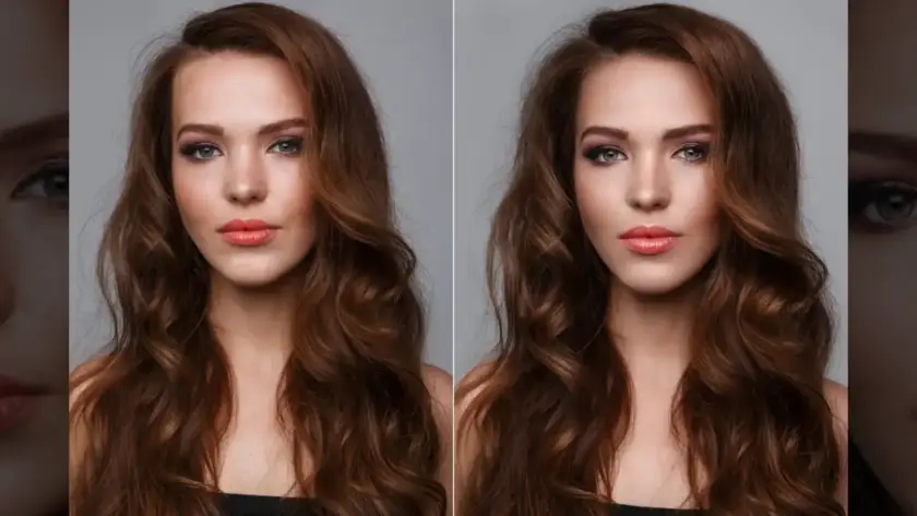 tress clinic forehead reduction surgery before and after