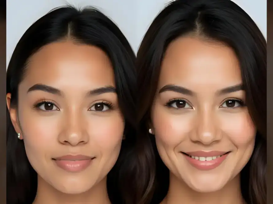 Tress_clinic_forehead_reduction_surgery